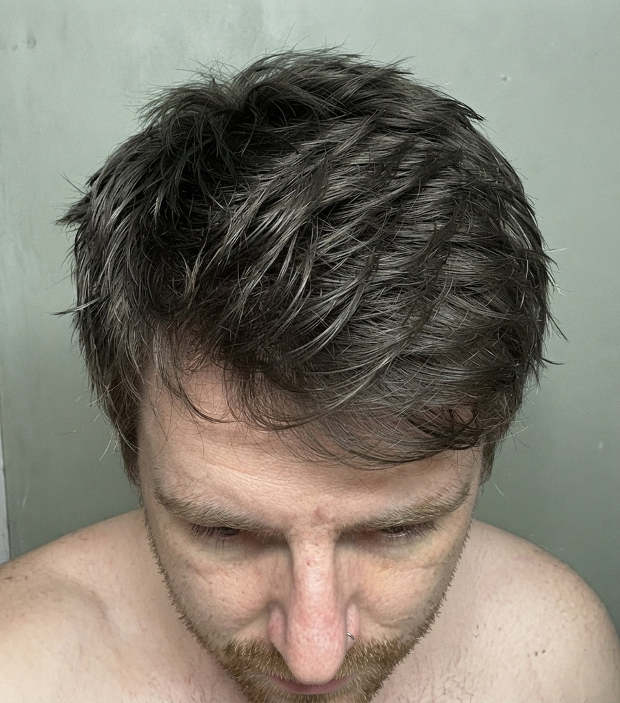 After